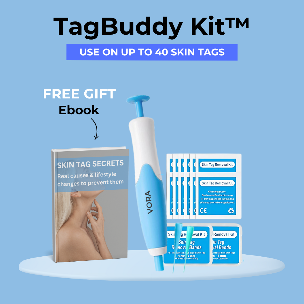 🔥Last Day Sale! 80% OFF!🔥||TagBuddy Kit – For Clearer Looking Skin at Home