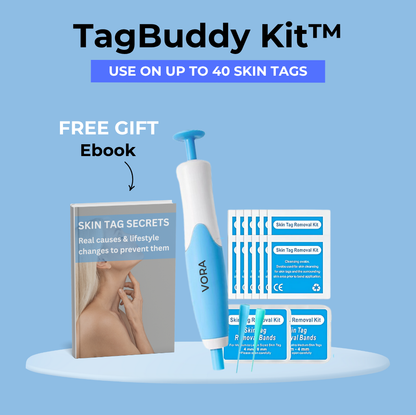 🔥Last Day Sale! 80% OFF!🔥||TagBuddy Kit – For Clearer Looking Skin at Home